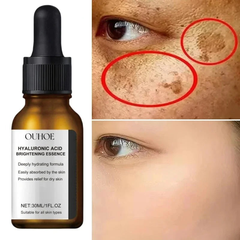 Dark Spots Remover Whitening Serum Face Freckle Melanin Correcting Reduce Fine Lines Brighten Essence Korean Beauty Skin Care