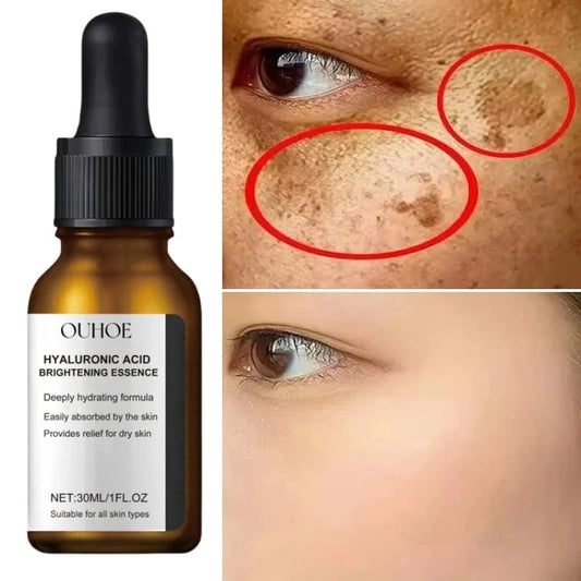 Dark Spots Remover Whitening Serum Face Freckle Melanin Correcting Reduce Fine Lines Brighten Essence Korean Beauty Skin Care