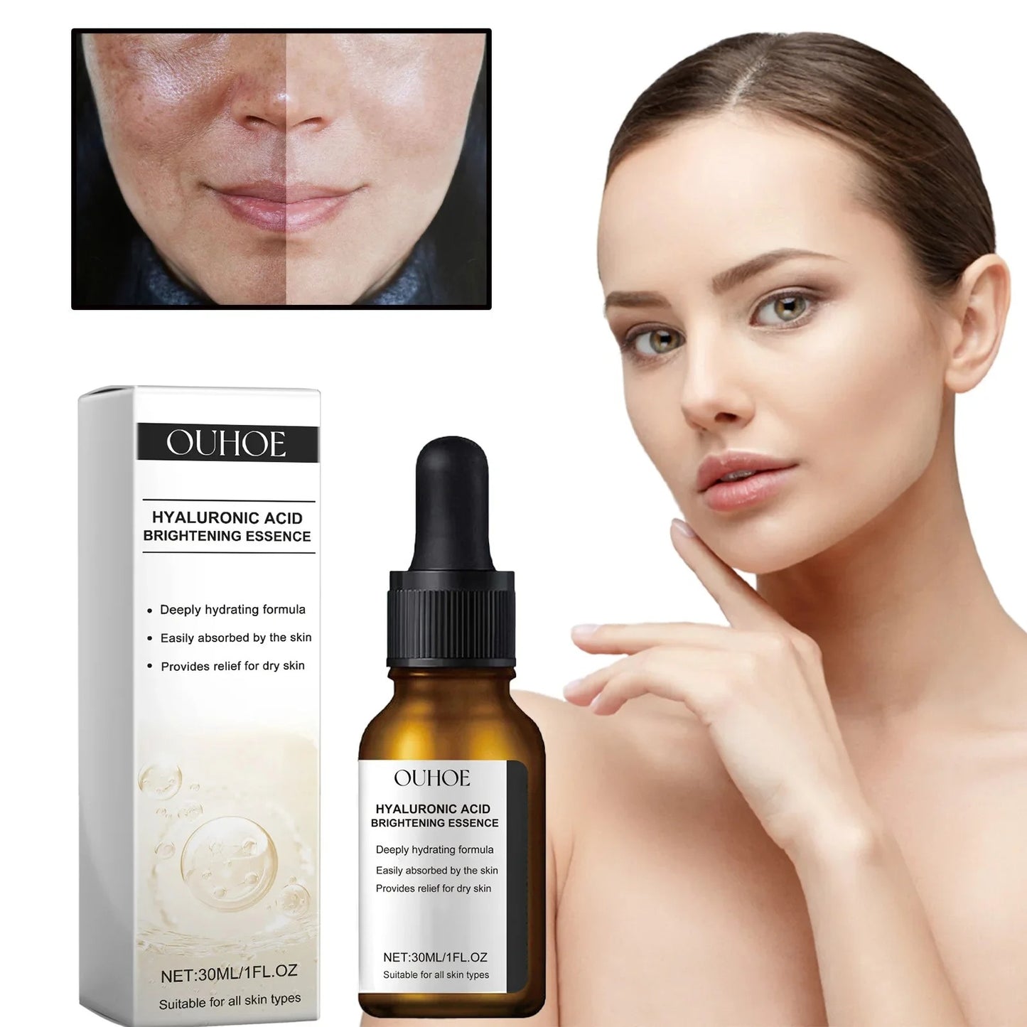 Dark Spots Remover Whitening Serum Face Freckle Melanin Correcting Reduce Fine Lines Brighten Essence Korean Beauty Skin Care