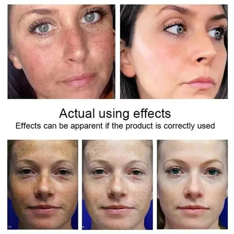 Dark Spots Remover Whitening Serum Face Freckle Melanin Correcting Reduce Fine Lines Brighten Essence Korean Beauty Skin Care